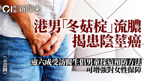 陰莖 黑痣|衛生福利部【台灣e院】